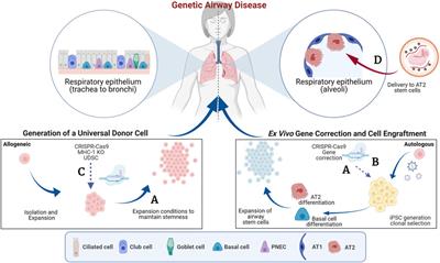 Editorial: Genome Editing to Treat Cystic Fibrosis and Other Pulmonary Diseases